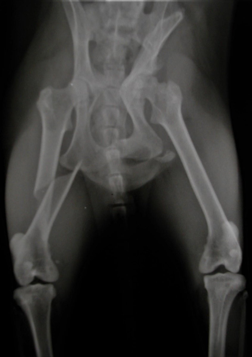 Röntgenbild vorher