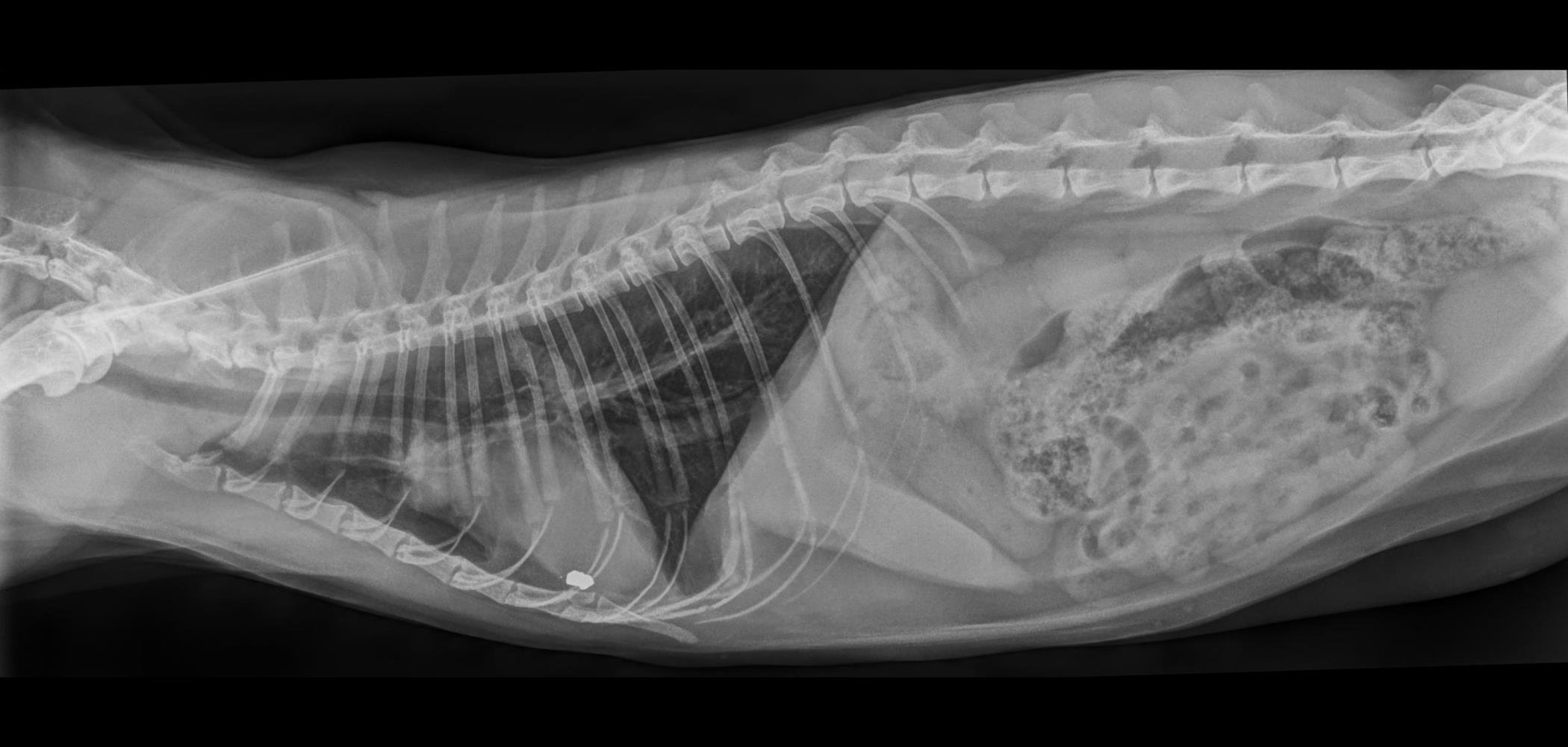 Röntgenbild Bauch